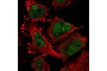 Immunofluorescent staining of human cell line U-251 MG shows localization to nucleoplasm & the Golgi apparatus.