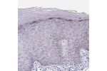Immunohistochemical staining of human skin shows moderate cytoplasmic positivity in keratinocytes in stratum granulosum.