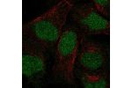 Immunofluorescent staining of human cell line U-2 OS shows localization to nucleoplasm.
