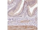 Immunohistochemical staining of human gallbladder shows cytoplasmic and membranous positivity in glandular cells.
