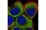 Immunofluorescent staining of human cell line A-431 shows localization to nucleoli, cytosol & endoplasmic reticulum.