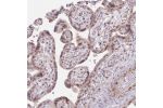 Immunohistochemical staining of human placenta shows moderate nuclear positivity in trophoblastic cells.