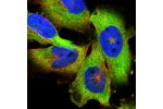 Immunofluorescent staining of human cell line U-251 MG shows localization to cytosol.