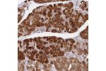 Immunohistochemical staining of human pancreas shows strong cytoplasmic positivity in exocrine glands.
