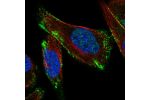 Immunofluorescent staining of human cell line RH-30 shows localization to plasma membrane & vesicles.