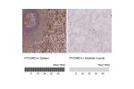 Immunohistochemistry analysis in human spleen and skeletal muscle tissues using HPA054496 antibody. Corresponding PYCARD RNA-seq data are presented for the same tissues.