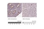 Immunohistochemistry analysis in human endometrium and pancreas tissues using Anti-DEK antibody. Corresponding DEK RNA-seq data are presented for the same tissues.