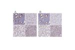 Immunohistochemical staining of human endometrium, heart muscle, kidney and pancreas using Anti-NONO antibody HPA054559 (A) shows similar protein distribution across tissues to independent antibody HPA054094 (B).