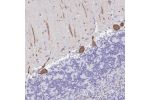 Immunohistochemical staining of human cerebellum shows strong cytoplasmic positivity in Purkinje cells.