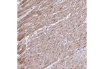 Immunohistochemical staining of human heart muscle shows moderate cytoplasmic positivity in myocytes.