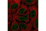 Immunofluorescent staining of human cell line CACO-2 shows localization to nucleoplasm.