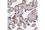 Immunohistochemical staining of human placenta shows strong cytoplasmic positivity in trophoblastic cells.
