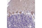 Immunohistochemical staining of human cerebellum shows moderate membranous positivity in Purkinje cells.