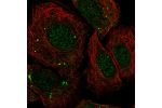 Immunofluorescent staining of human cell line SiHa shows localization to nucleoplasm & vesicles.