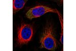 Immunofluorescent staining of human cell line HeLa shows localization to cytosol.