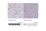 Immunohistochemistry analysis in human placenta and pancreas tissues using Anti-CLTA antibody. Corresponding CLTA RNA-seq data are presented for the same tissues.