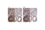 Immunohistochemical staining of human endometrium, kidney, lymphoid tissues and testis using Anti-SFPQ antibody HPA054689 (A) shows similar protein distribution across tissues to independent antibody HPA047513 (B).
