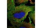Immunofluorescent staining of human cell line U-2 OS shows localization to plasma membrane & cytosol.