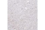 Immunohistochemical staining of human hippocampus shows positivity in cell projections.