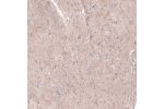 Immunohistochemical staining of human cerebral cortex shows moderate positivity in a subset of neural fibers.