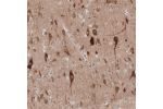 Immunohistochemical staining of human cerebral cortex shows moderate cytoplasmic positivity in neurons.