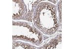 Immunohistochemical staining of human testis shows strong cytoplasmic positivity in cells in seminiferous ducts.