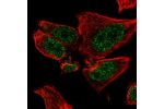 Immunofluorescent staining of human cell line PC-3 shows localization to nucleoplasm.