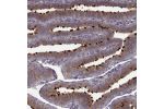 Immunohistochemical staining of human fallopian tube shows strong positivity in cilia in a subset of glandular cells.