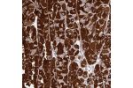 Immunohistochemical staining of human stomach shows strong cytoplasmic positivity in glandular cells.