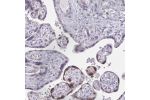 Immunohistochemical staining of human placenta shows strong nuclear positivity in a subset of trophoblastic cells.