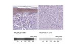 Immunohistochemistry analysis in human skin and liver tissues using HPA055067 antibody. Corresponding TACSTD2 RNA-seq data are presented for the same tissues.