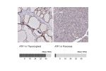 Immunohistochemistry analysis in human thyroid gland and pancreas tissues using Anti-ATF1 antibody. Corresponding ATF1 RNA-seq data are presented for the same tissues.