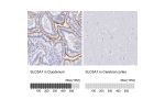 Immunohistochemistry analysis in human duodenum and cerebral cortex tissues using HPA055106 antibody. Corresponding SLC5A1 RNA-seq data are presented for the same tissues.