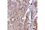 Immunohistochemical staining of human smooth muscle shows strong membranous positivity in smooth muscle cells.