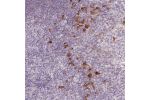 Immunohistochemical staining of human tonsil shows strong cytoplasmic positivity in non-germinal center cells.