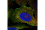 Immunofluorescent staining of human cell line U-2 OS shows localization to nucleoli fibrillar center, plasma membrane & cytosol.