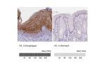 Immunohistochemistry analysis in human esophagus and stomach tissues using HPA055211 antibody. Corresponding IVL RNA-seq data are presented for the same tissues.