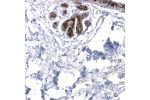 Immunohistochemical staining of human duodenum shows strong cytoplasmic/membranous positivity in a subset of lymphoid cells, possibly mast cells.
