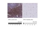 Immunohistochemistry analysis in human lymph node and cerebral cortex tissues using Anti-SPN antibody. Corresponding SPN RNA-seq data are presented for the same tissues.