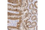 Immunohistochemical staining of human esophagus shows membrane positivity in squamous epithelial cells.