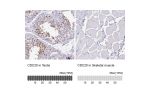 Immunohistochemistry analysis in human testis and skeletal muscle tissues using HPA055288 antibody. Corresponding CDC20 RNA-seq data are presented for the same tissues.