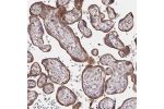 Immunohistochemical staining of human placenta shows strong cytoplasmic positivity in trophoblastic cells.