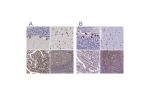 Immunohistochemical staining of human cerebellum, cerebral cortex, gastrointestinal and lymphoid tissues using Anti-EEF1G antibody HPA055316 (A) shows similar protein distribution across tissues to independent antibody HPA040688 (B).