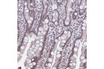 Immunohistochemical staining of human small intestine shows moderate nuclear positivity in glandular cells.