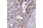 Immunohistochemical staining of human placenta shows moderate to strong cytoplasmic positivity in Hofbauer cells.