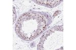 Immunohistochemical staining of human testis shows moderate nuclear positivity in cells in seminiferous ducts.