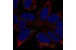 Immunofluorescent staining of human cell line AF22 shows localization to the Golgi apparatus.