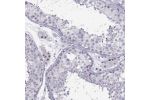 Immunohistochemical staining of human testis shows strong nuclear positivity in Leydig cells.