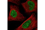 Immunofluorescent staining of human cell line U-2 OS shows localization to nucleoplasm.