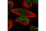 Immunofluorescent staining of human cell line U-251 MG shows localization to nucleoplasm.